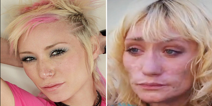Before and after meth... article image