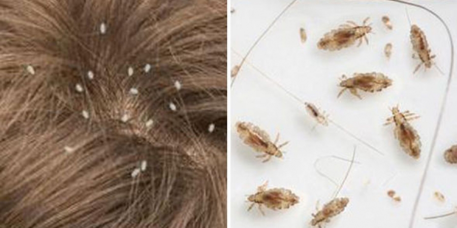 Found nits but no live bugs