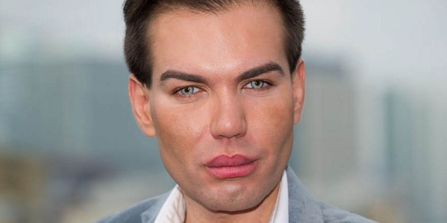 Human Ken doll goes under the surgeons knife again for weird ass implants article image