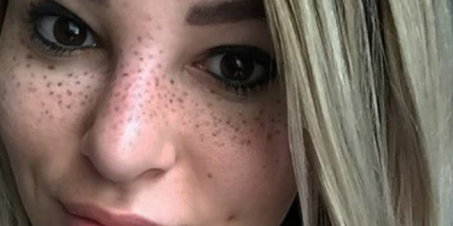 Women are now getting bizarre freckles tattooed on their faces! article image