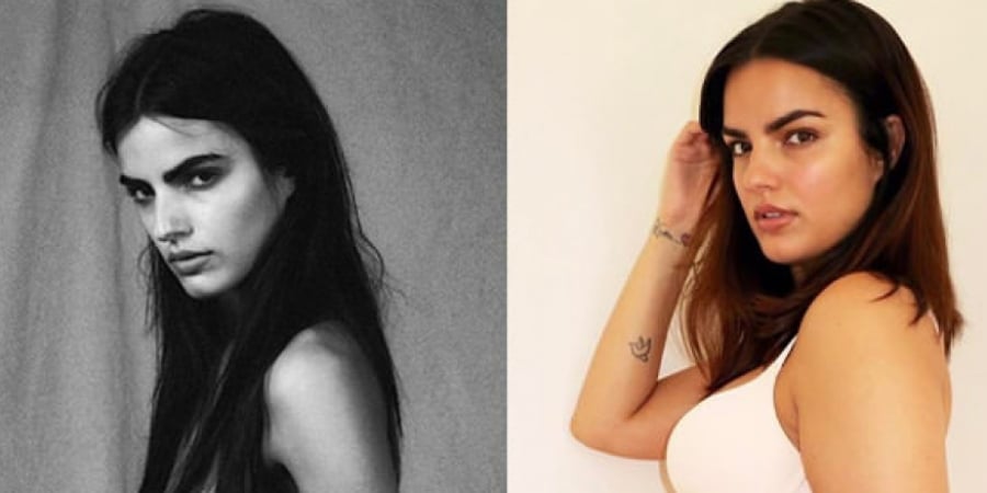 Model shared before and after photos of extreme body transformation article image
