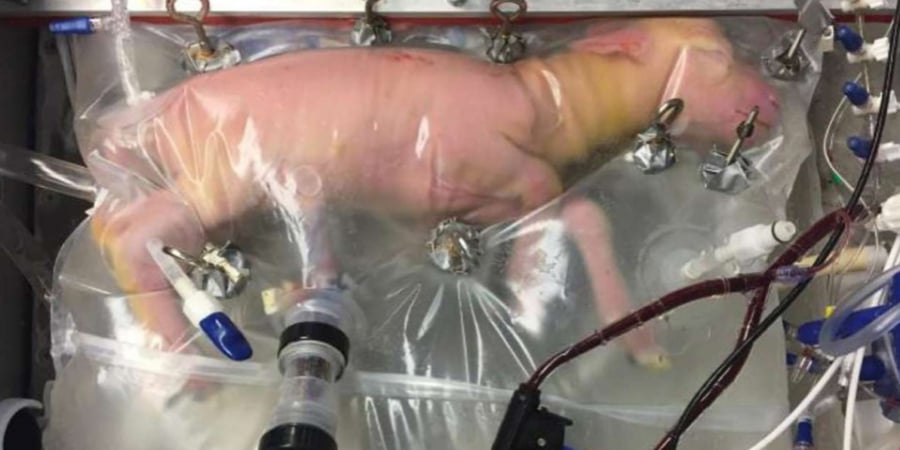 Scientists have successfully created an artifical womb article image