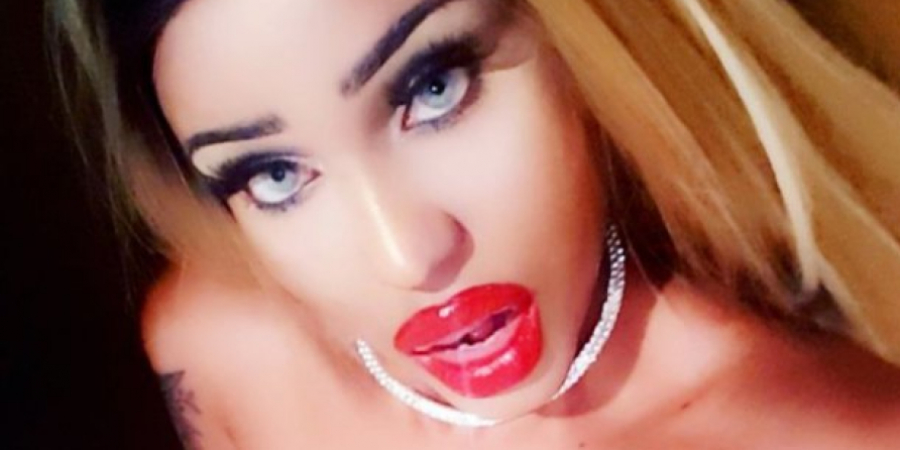 Woman spends £10k on surgery to look like a blow up doll article image