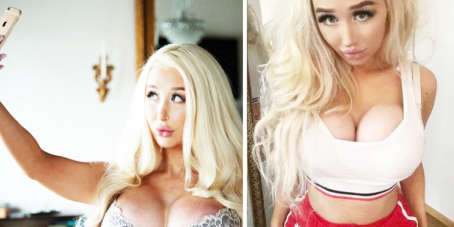 Girl inflates her boobs to 30GG in a bid to look like Barbie article image