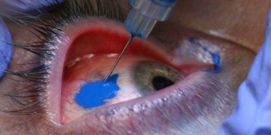 Dude gets his eyeball tattooed & it's bloody revolting article image