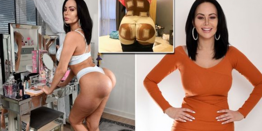 Plastic surgery addict can't sit down after being left with botched bum implants article image