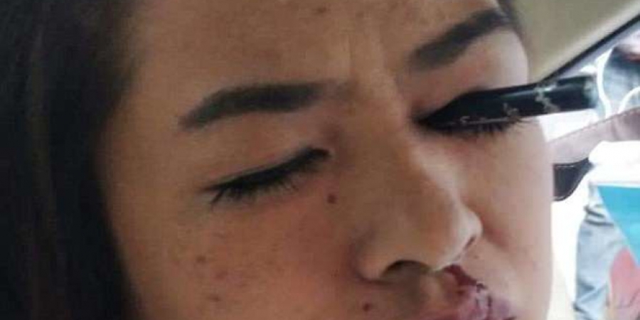 Woman gets eyeliner stuck in her eye after doing her makeup in the car article image