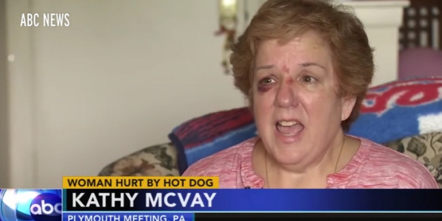 Philadelphia Phillies fan injured after she was hit in the face by flying hotdog article image