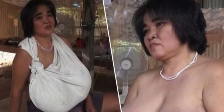 Doctors can't figure out why this woman's boobs won't stop growing article image