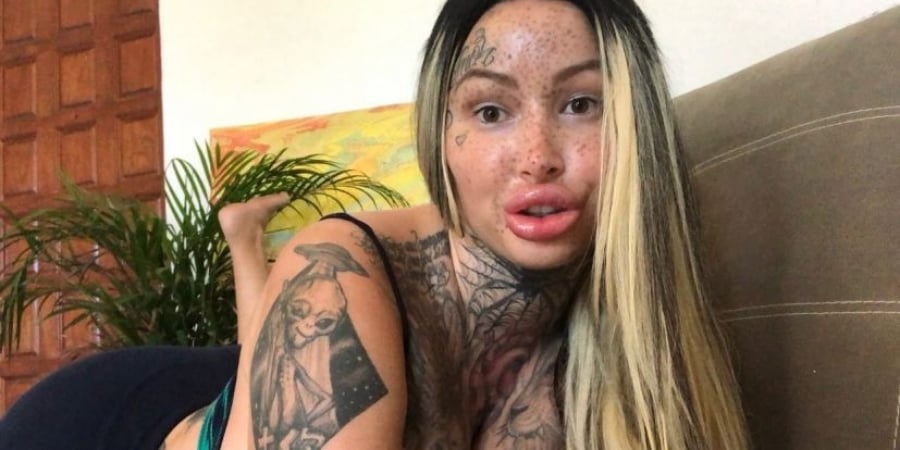 Model undergoes surgery to achieve 'fattest vagina in the world' article image
