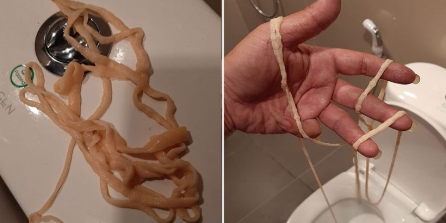 Man pulls 32ft LIVE tapeworm from his ass! article image