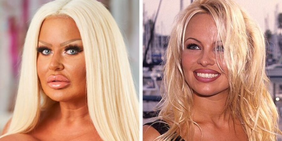 West Sussex woman forks out thousands to look like Pamela Anderson article image