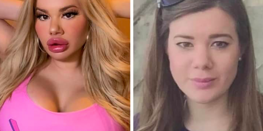 Proud bimbo reveals her posh family’s reaction to her extreme look article image